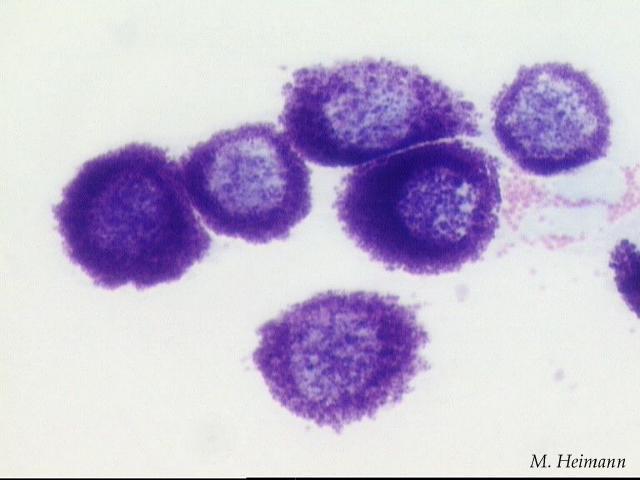 Mastocytome: cytologie Mastocytome: cytologie