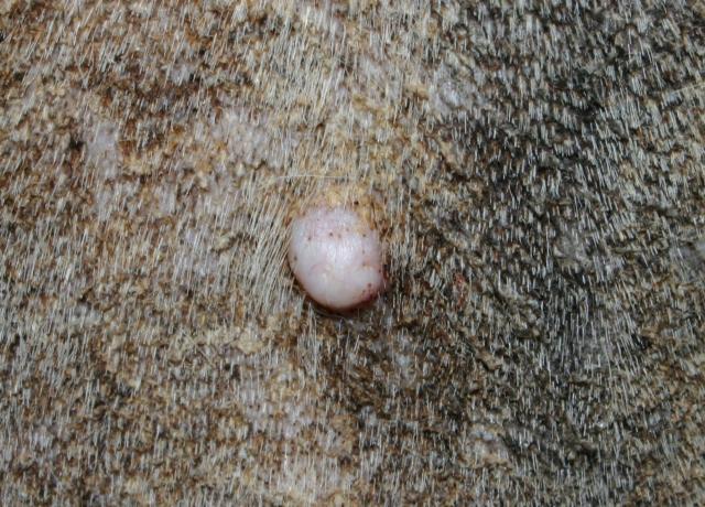 Mastocytome (Tumeur maligne) Mastocytome (Tumeur maligne)