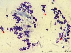 Levures de type Malassezia (cytologie colorée) (origine: Mérial)