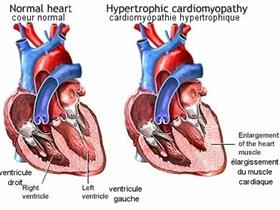 Pathologies cardiaques - Cardiomyopathie hypertrophique - HCM - Maladie du coeur chez le chat