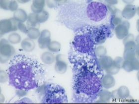 Mélanocytes (examen microscopique: cliché M Heimann)
