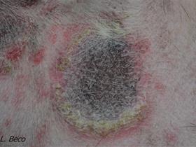 Target lesion - Suggested guidelines for using systemic antimicrobials in bacterial skin infections (Pyoderma)