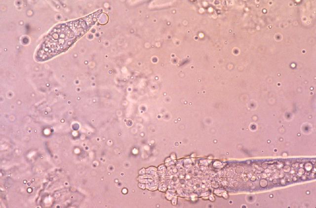 Demodectic mange (demodicosis) - Parasites - parasitic ...