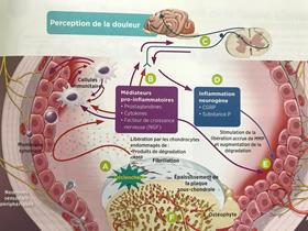 Pain and inflammation cycle in osteoarthritis (Zoetis)