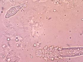 Demodex canis (adult and egg)