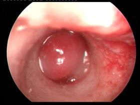 Ear polyp in a cat - Ohrenentzündung