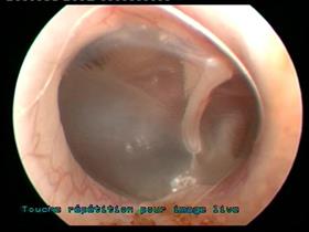 Normal tympanic membrane (Cat)