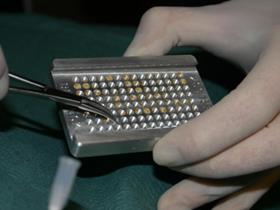 Implants Goldtreat - Goldtreat - Implants d'Or pour traiter l'arthrose