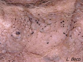 Idiopathic Mucinosis in Shar Peï