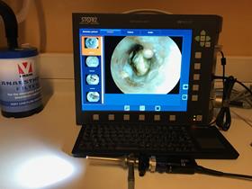 Videootoscopy Storz - Medical Imaging